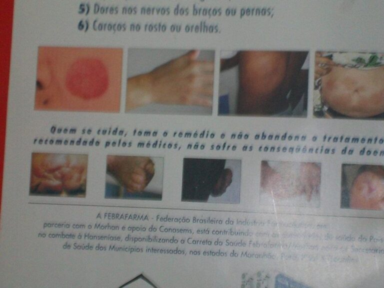 Conselho Nacional de Saúde convoca ato saúde + 10 pelo financiamento do SUS.